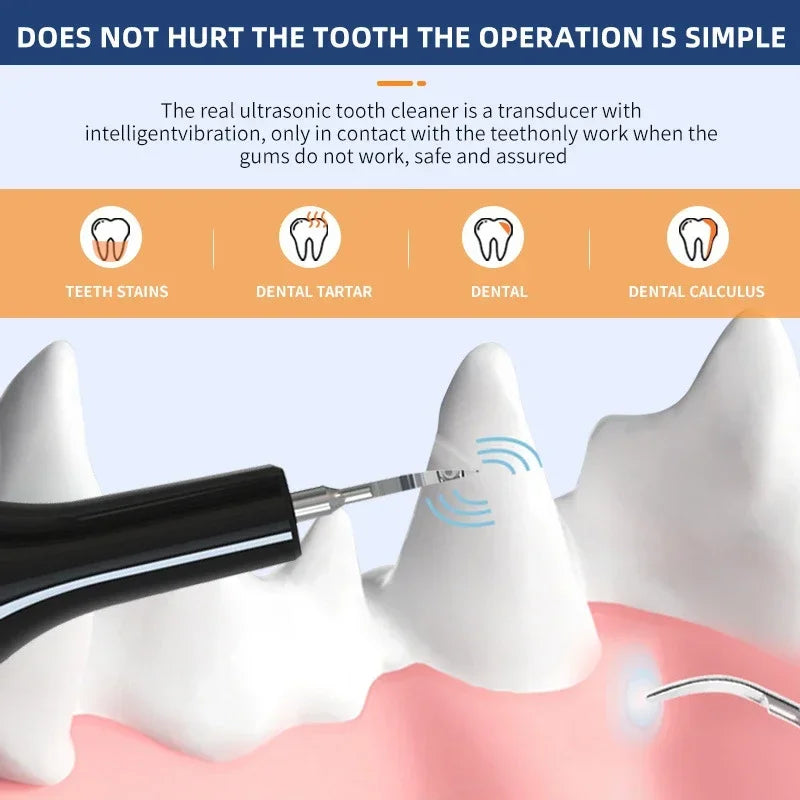 Pet Teeth Cleaning Tools Toothbrush - Essential for Oral Health